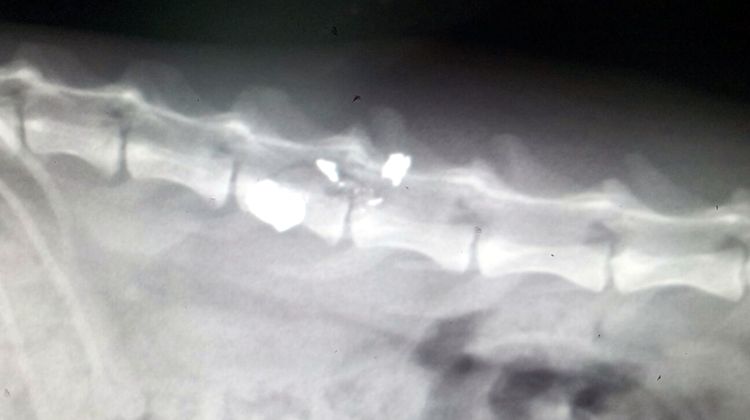 Detall de la radiografia on es veuen els trossos de perdigó que han seccionat la medul·la